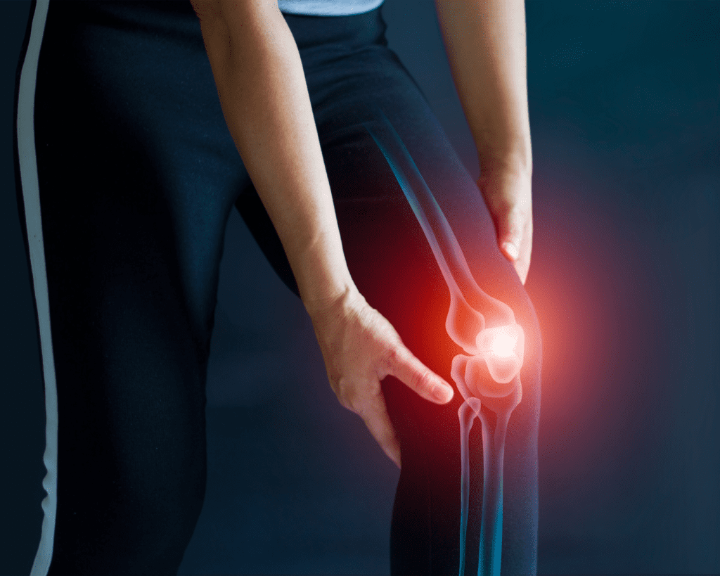 Imagen de una persona con problema articular de la rodilla, asociada a enfermedades reumáticas inflamatorias o no inflamatorias